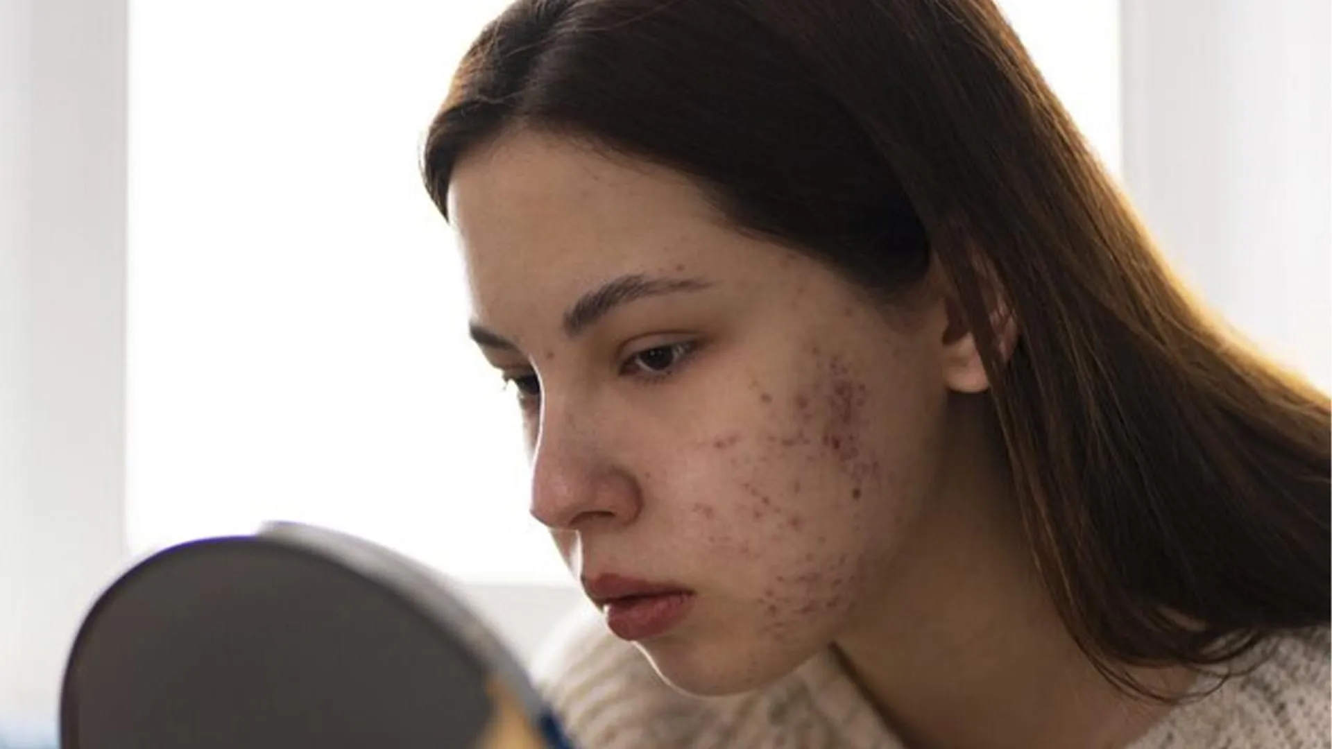 «Появляются инфекции»: косметолог рассказала, как нельзя умываться