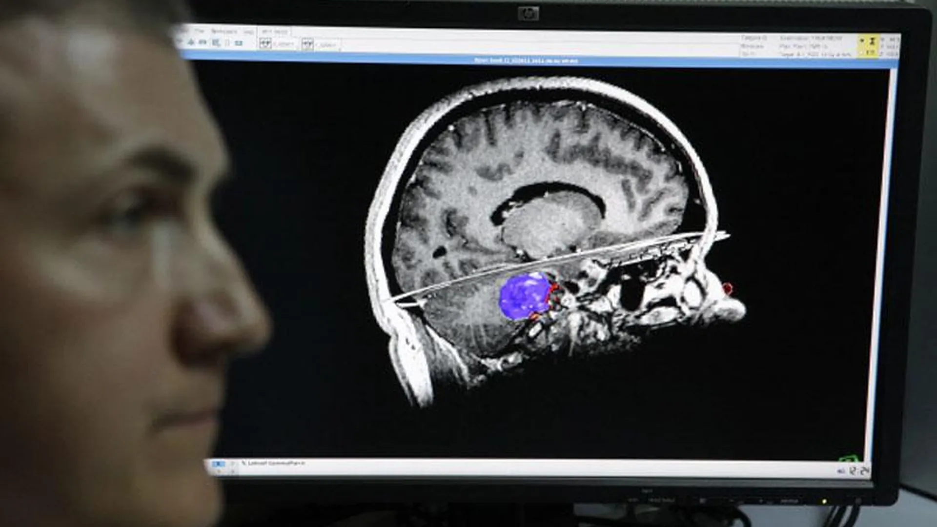 Ученые просят людей жертвовать свой мозг после смерти науке