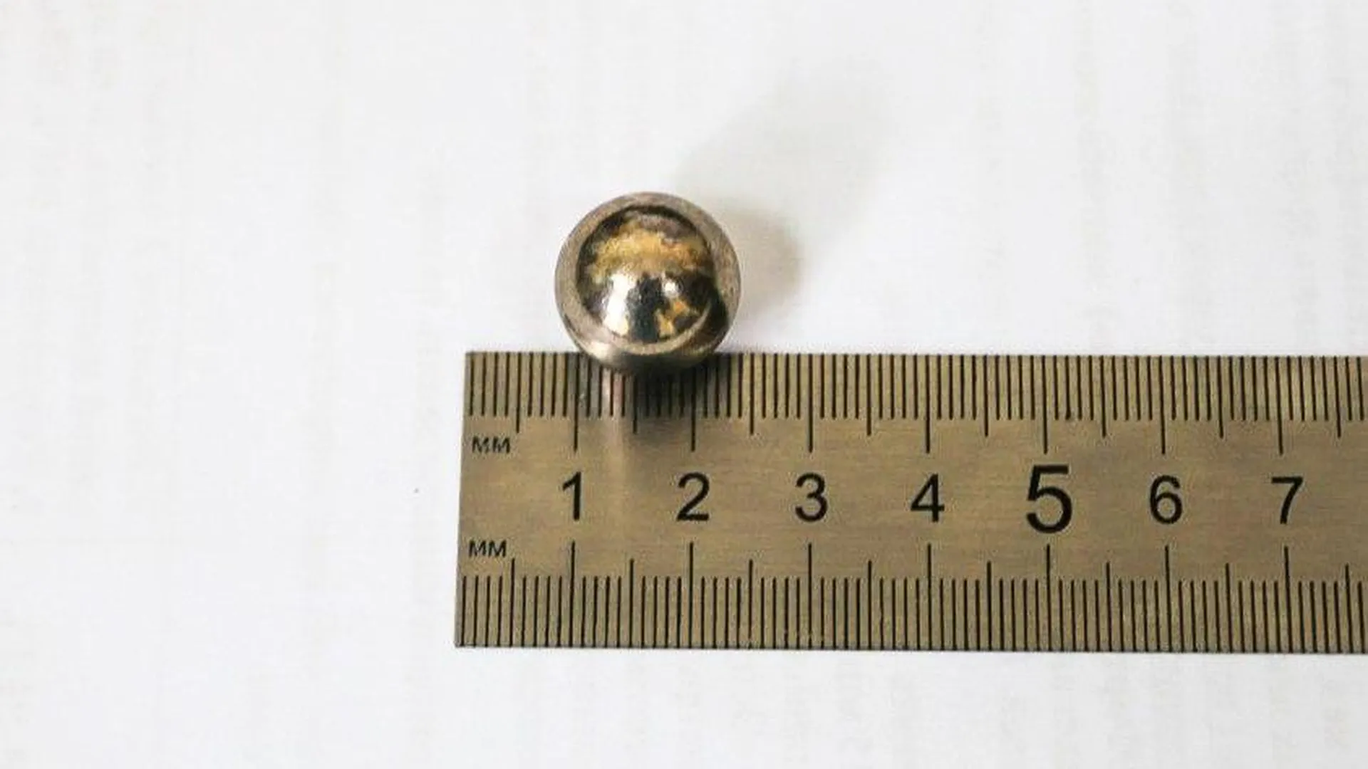 Металлический шарик диаметром 1,5 сантиметра достали из желудка 8-летнего ребенка подмосковные врачи