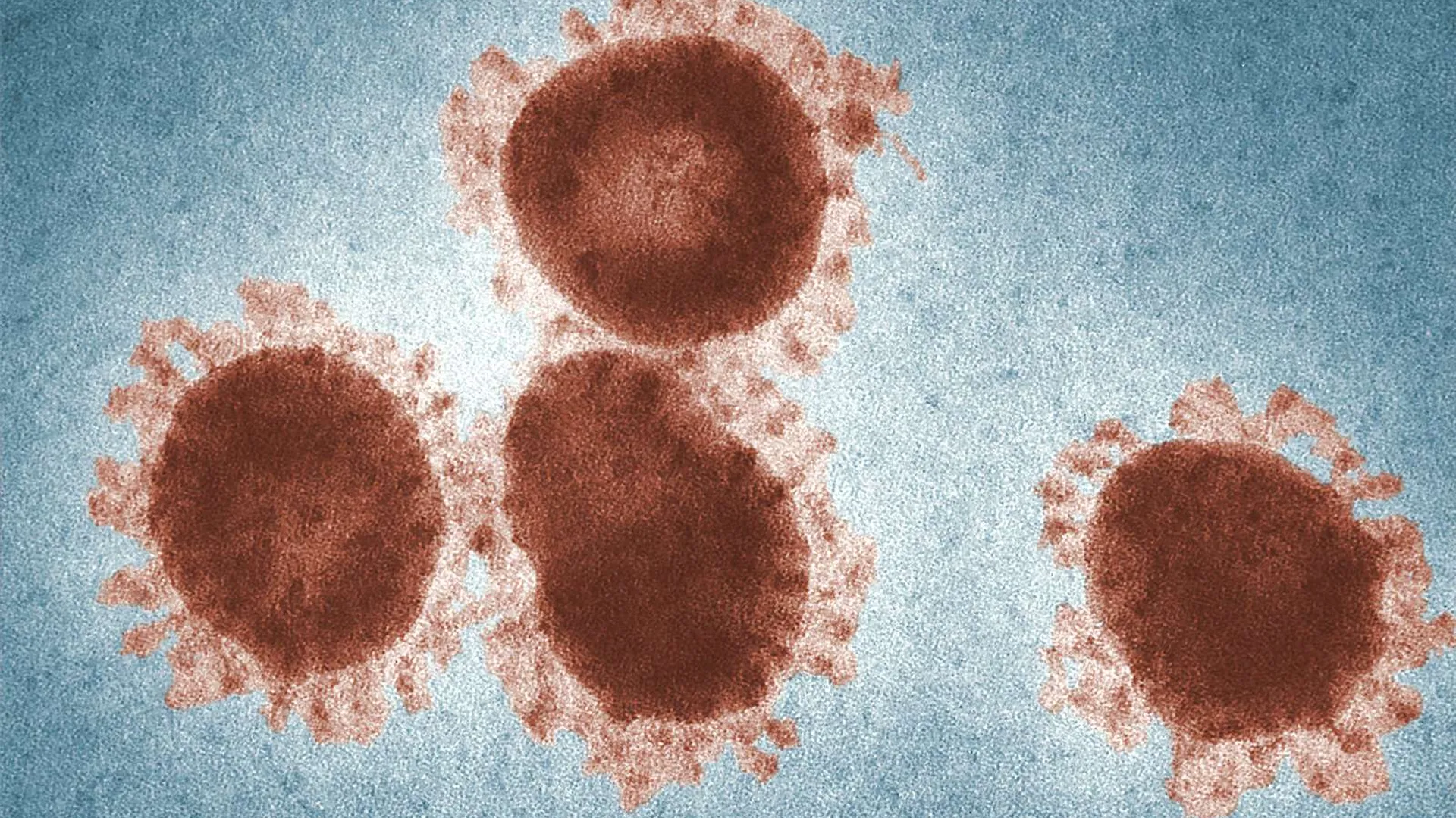 Коронавирус под электронным микроскопом. SARS-cov-2 Дельта штамм. Респираторный коронавирус. Коронавирус под микроскопом.