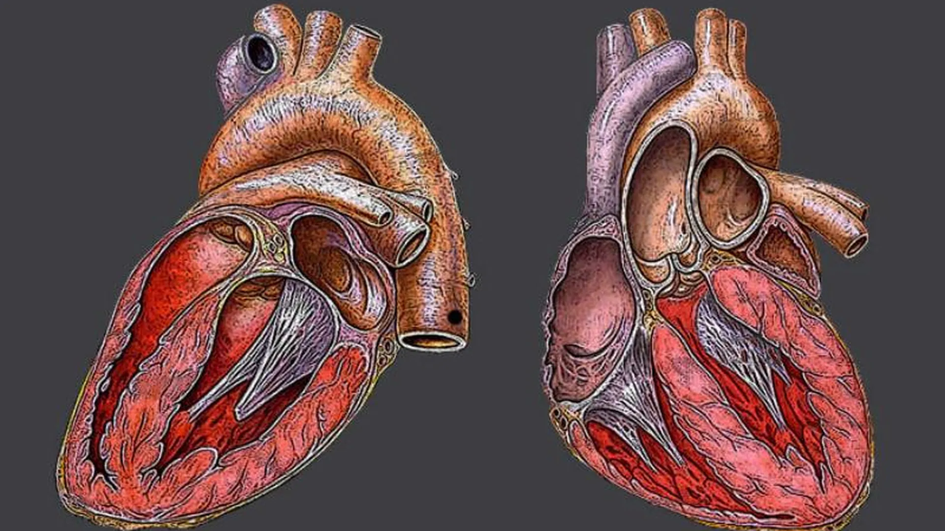Сильное биение сердца при нормальном пульсе, обычно в лежачем положении, как избавиться?