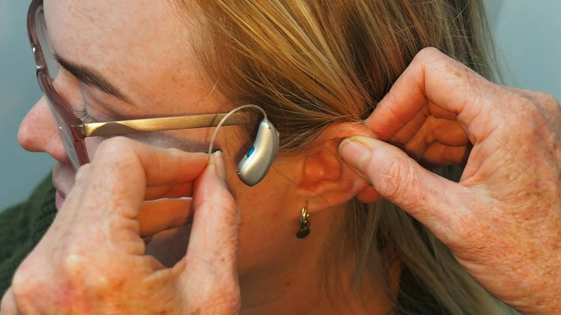 Свыше 3 тысяч жителей Подмосковья получат протезы и слуховые аппараты в этом году