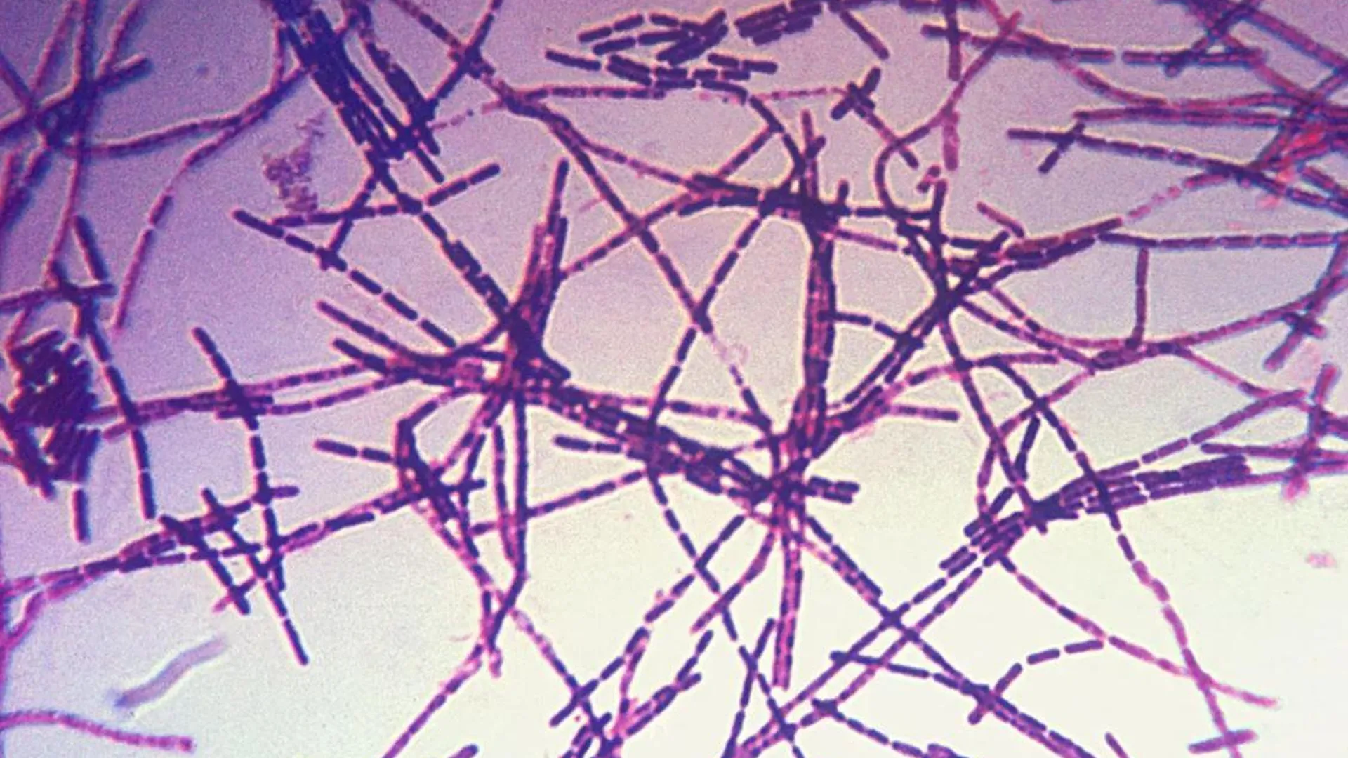 Микрофотография бацилл сибирской язвы / CDC