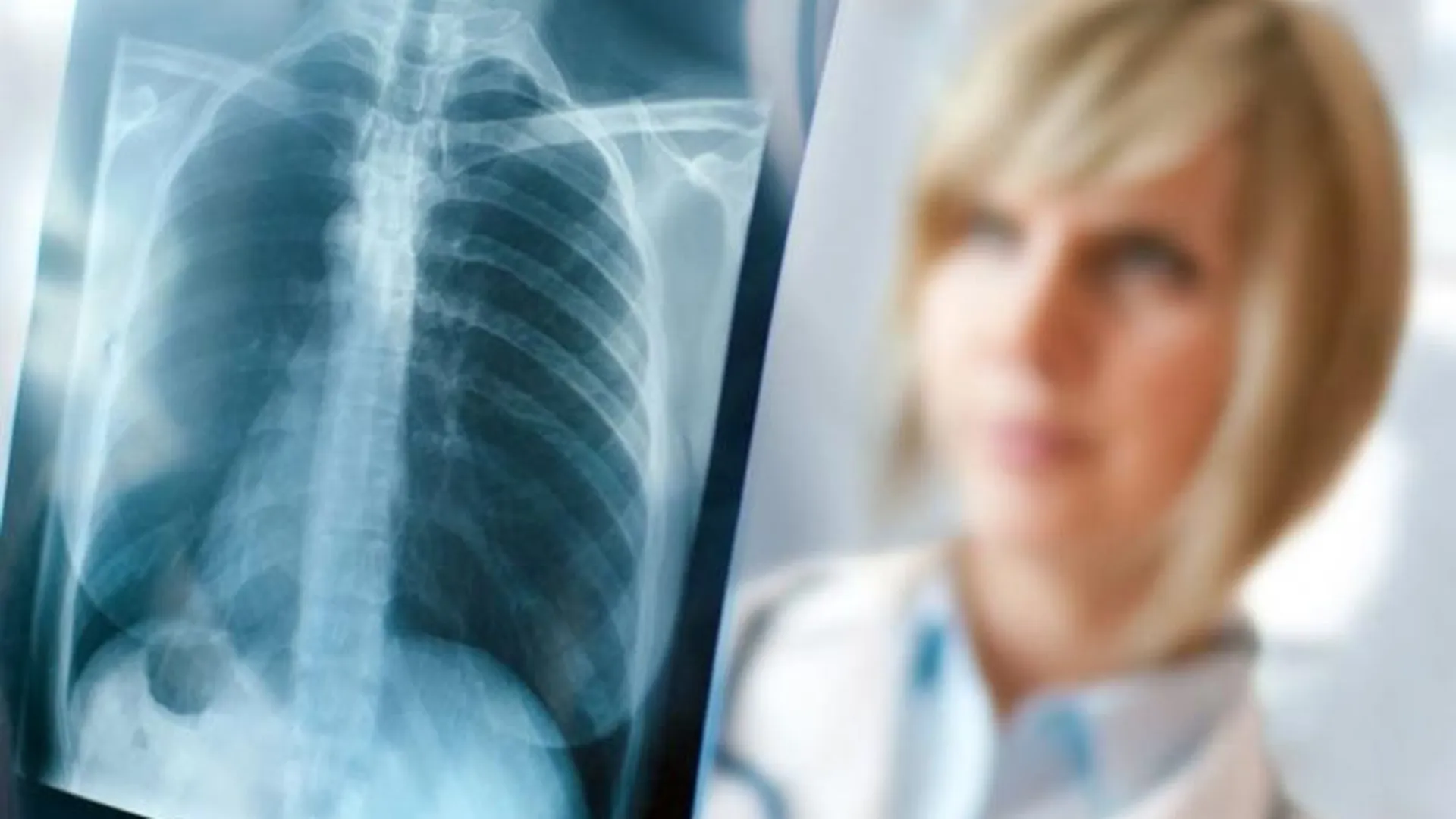 Активисты ОНФ просят поставить новый рентген-аппарат в Коломну